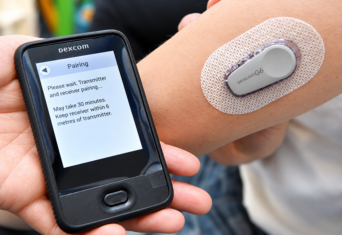 Dexcom G6 sensor met zender op de bovenarm en een ontvanger die het koppelingsscherm voorbeeld verbinding toont.
