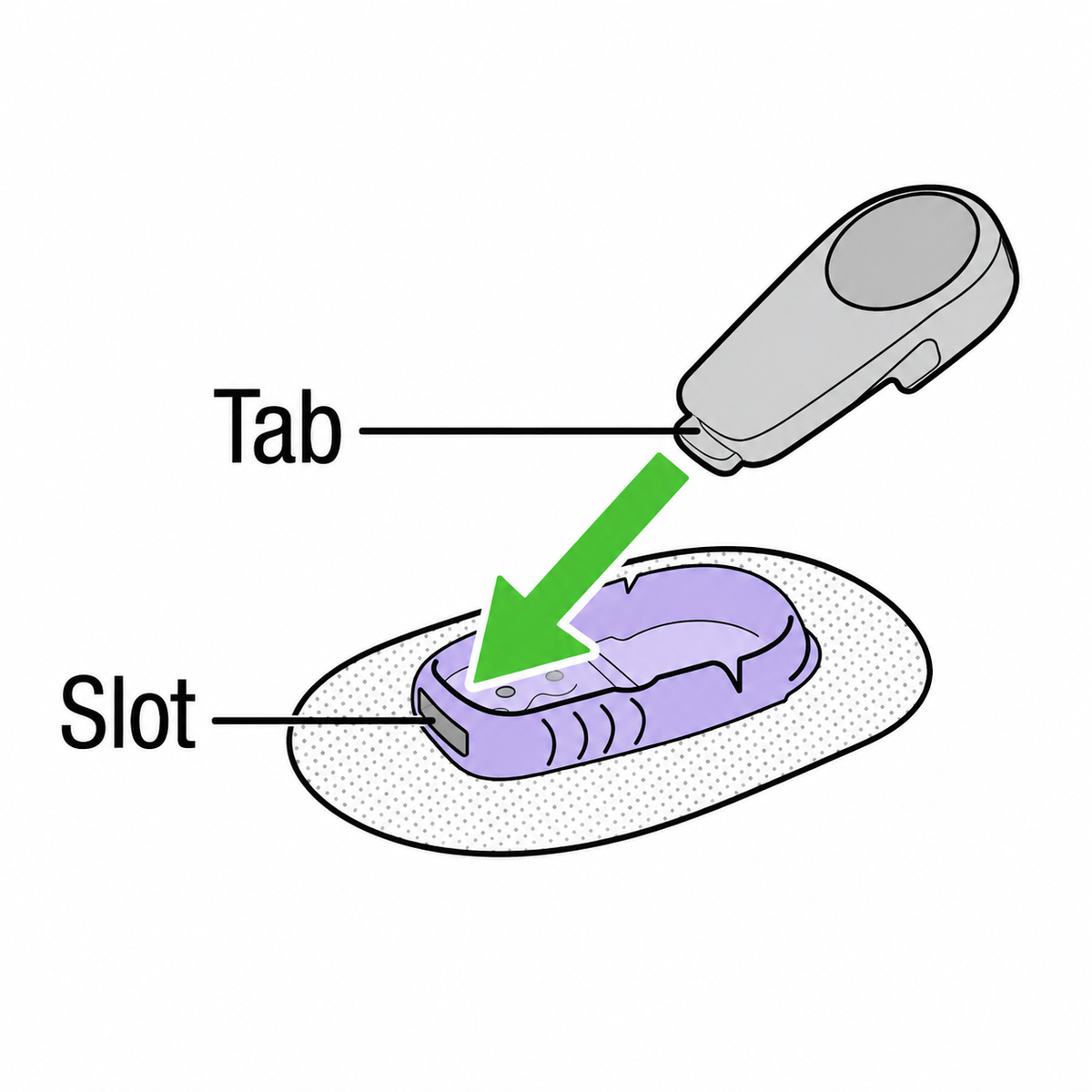 Dexcom G6 Transmitter installatiehandleiding