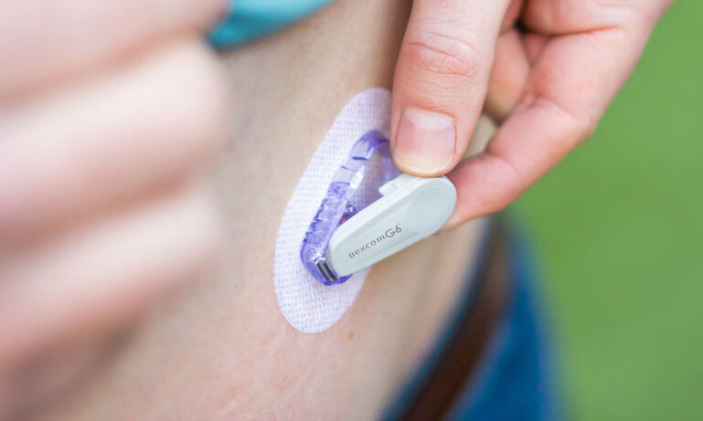 Dexcom G6 Transmitter / Zender - Voor betrouwbare CGM-metingen