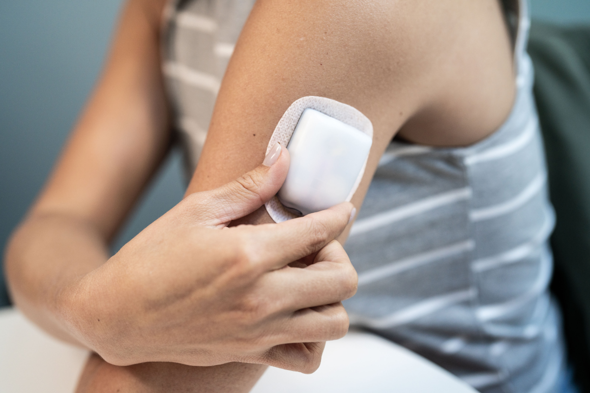 Omnipod 5 insulinepod op de buik aangebracht